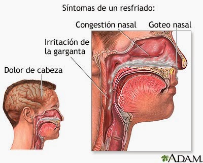 Dolor de cabeza oido tapado